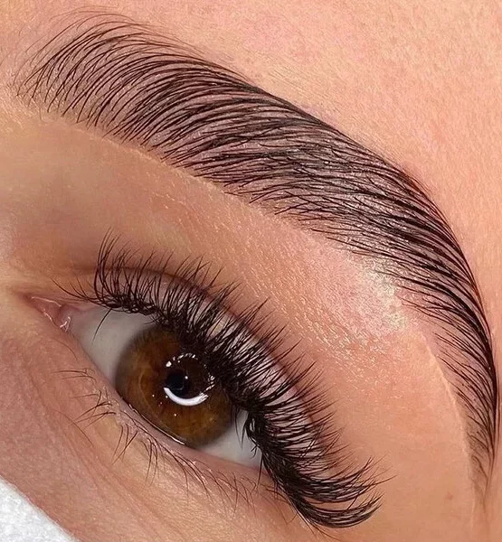 Browlift